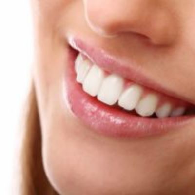 Girl smiling having white teeth